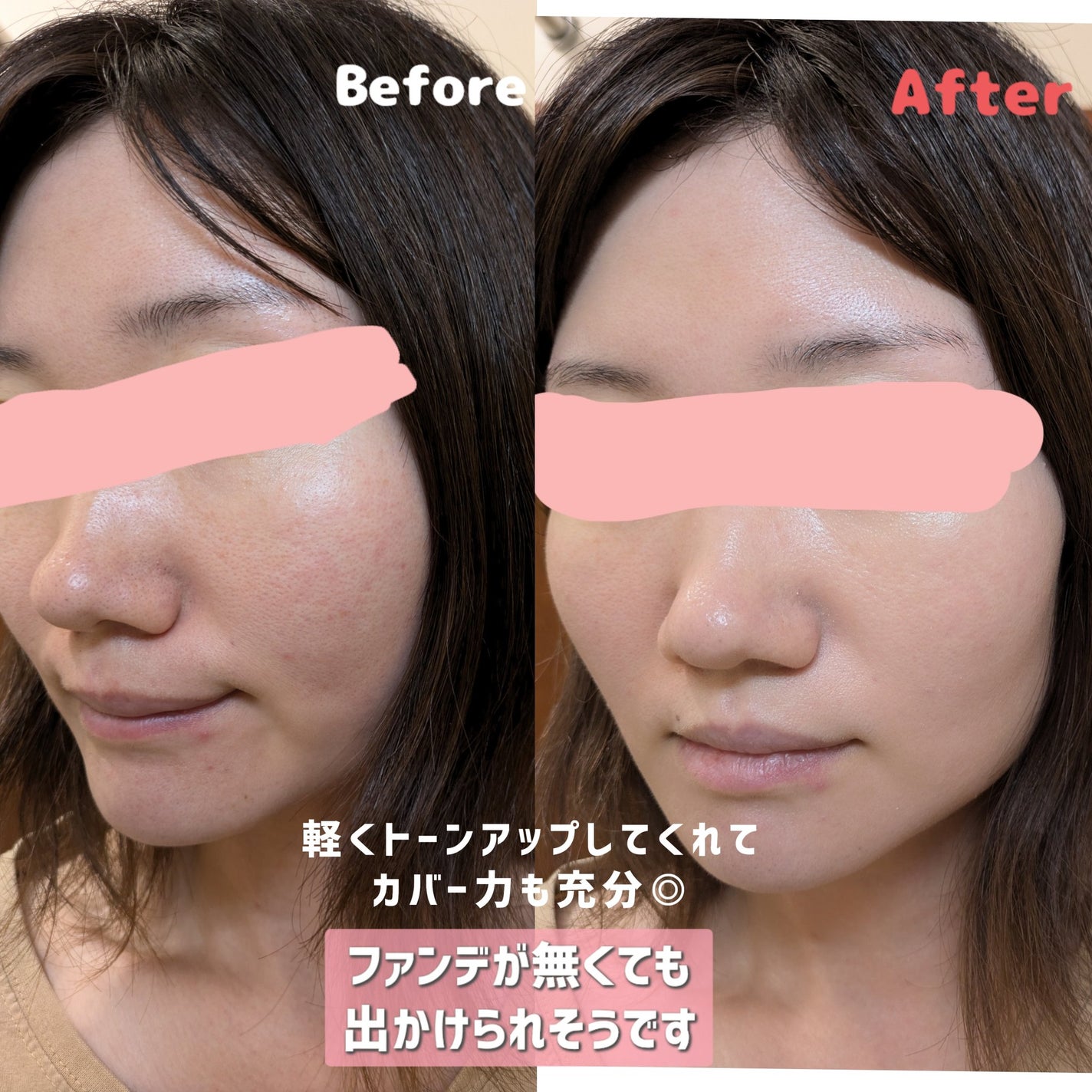 ããã³ ã¢ããã¢ã€ã¹ã ãšã€ãžã³ã°ã±ã¢ ãã€ã¯ãªãŒã UV/ããã³/æ¥çŒãæ¢ãã¯ãªãŒã ã䜿ã£ãã¯ãã³ãïŒ5æç®ïŒ