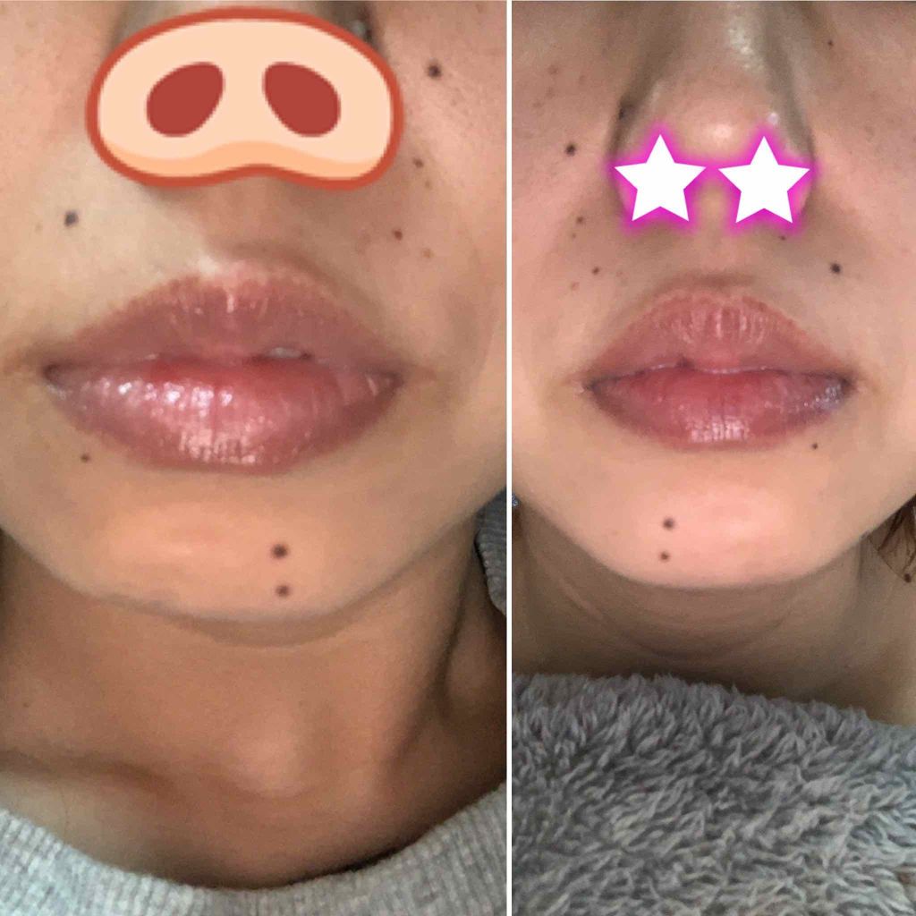 セネシス プラセン100/スノーデン/美容液を使ったクチコミ（3枚目）