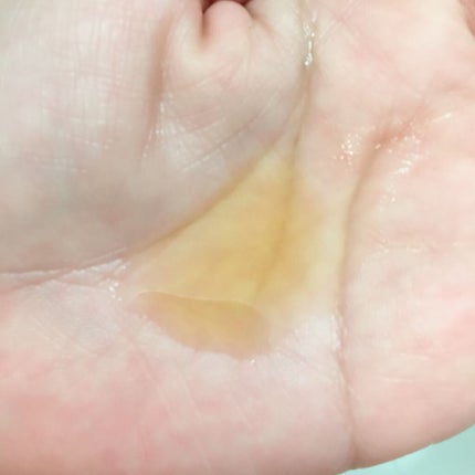 ガラクトミセスピュアビタミンCグロートナー/SOME BY MI/化粧水を使ったクチコミ(2枚目)