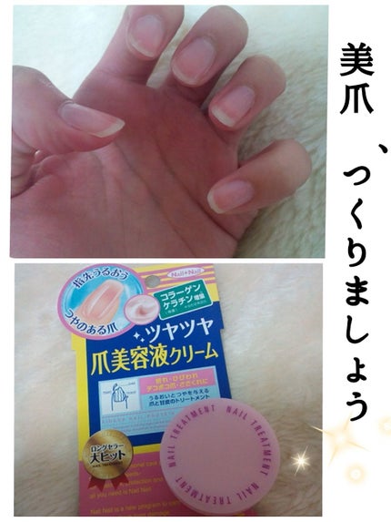 ネイルトリートメント N/ネイルネイル/ネイルオイル・トリートメントを使ったクチコミ(1枚目)