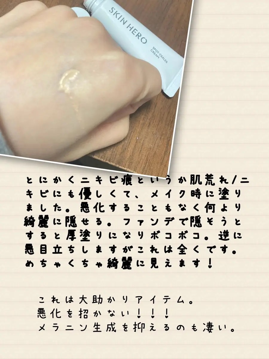 薬用スポットシーラークリーム/スキンヒーロー/クリームコンシーラーを使ったクチコミ（3枚目）