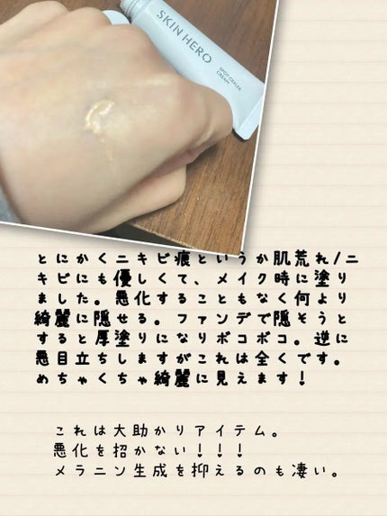 薬用スポットシーラークリーム/スキンヒーロー/クリームコンシーラーを使ったクチコミ(3枚目)