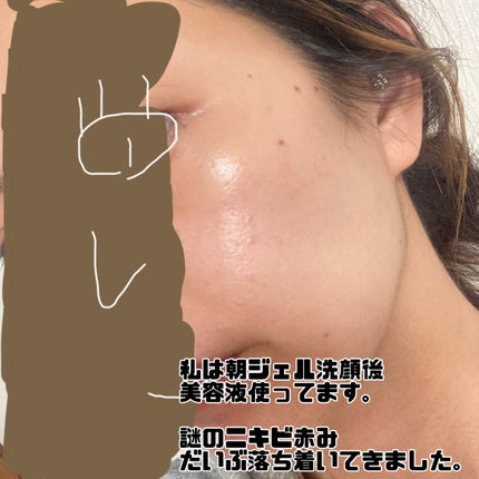 バイタルエナジー ホワイトニングエッセンスCプラス/メイコー化粧品/美容液を使ったクチコミ(5枚目)