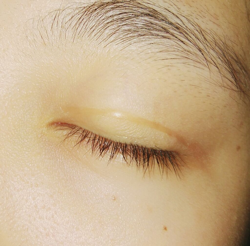 アイテープ片面(のびる)絆創膏タイプ スリム 120枚/セリア/二重まぶた用アイテムを使ったクチコミ（2枚目）