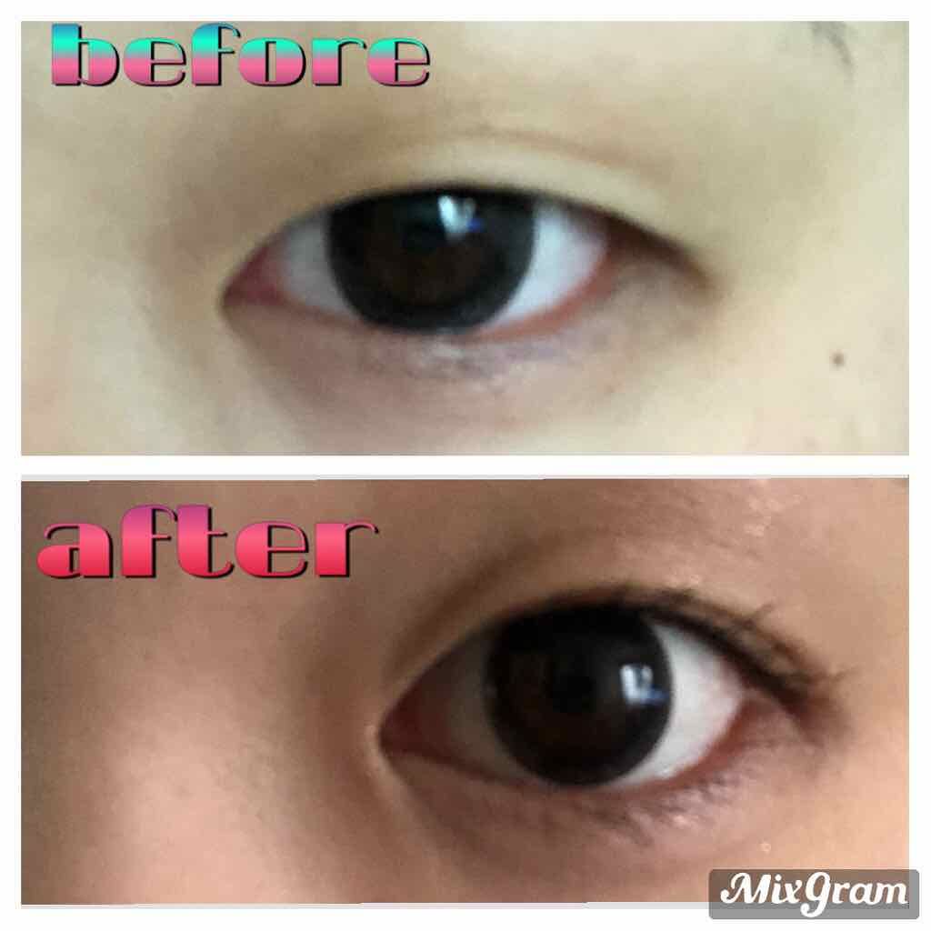 ワンダーアイリッドテープ Extra/D-UP/二重まぶた用アイテムを使ったクチコミ(2枚目)