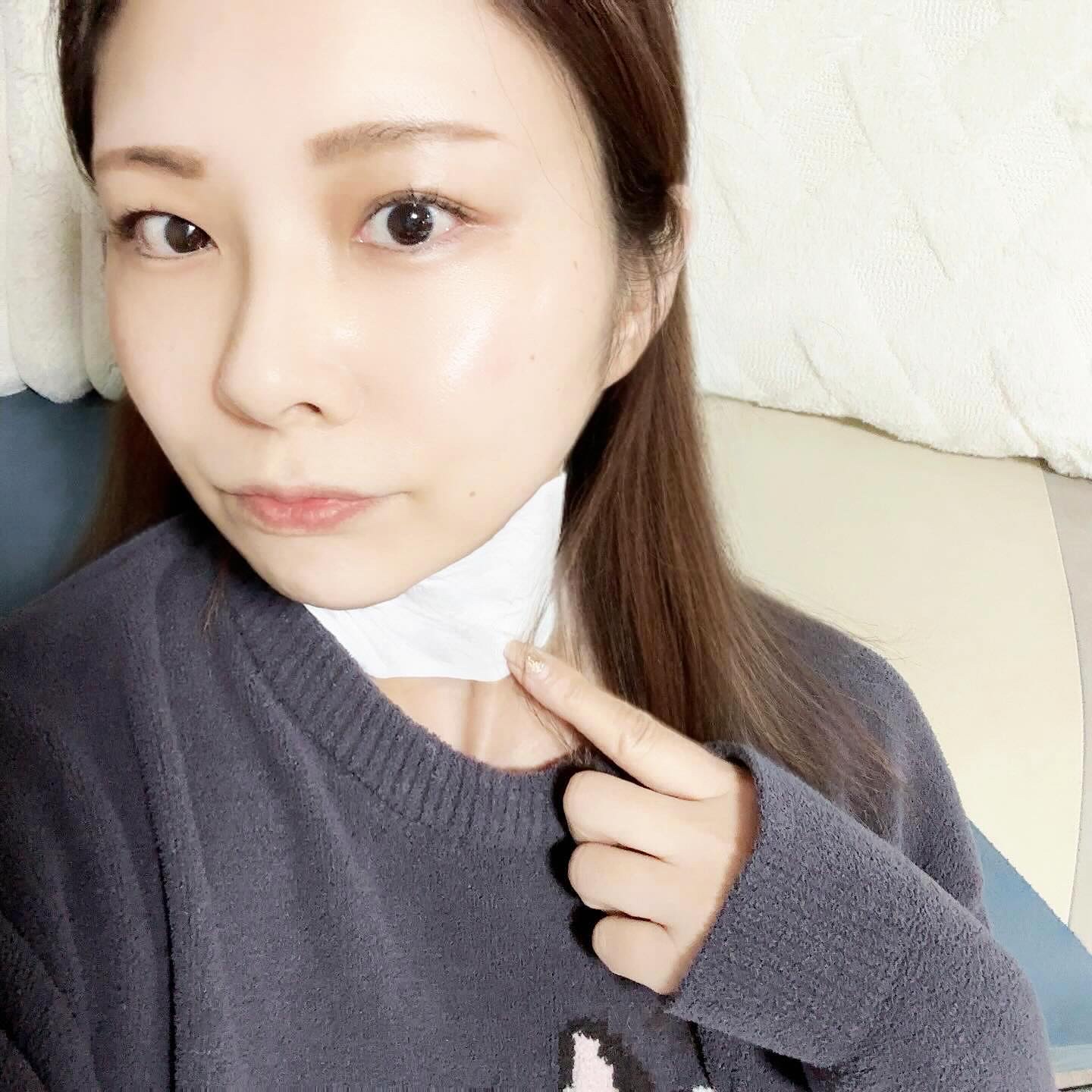 バイオティクスバイタルネックパッチ/VARI:HOPE/ネック・デコルテケアを使ったクチコミ（3枚目）