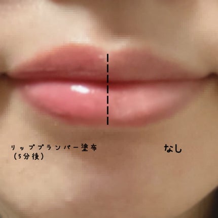 ドトムリッププラスプランパー/keybo/リッププランパーを使ったクチコミ(2枚目)