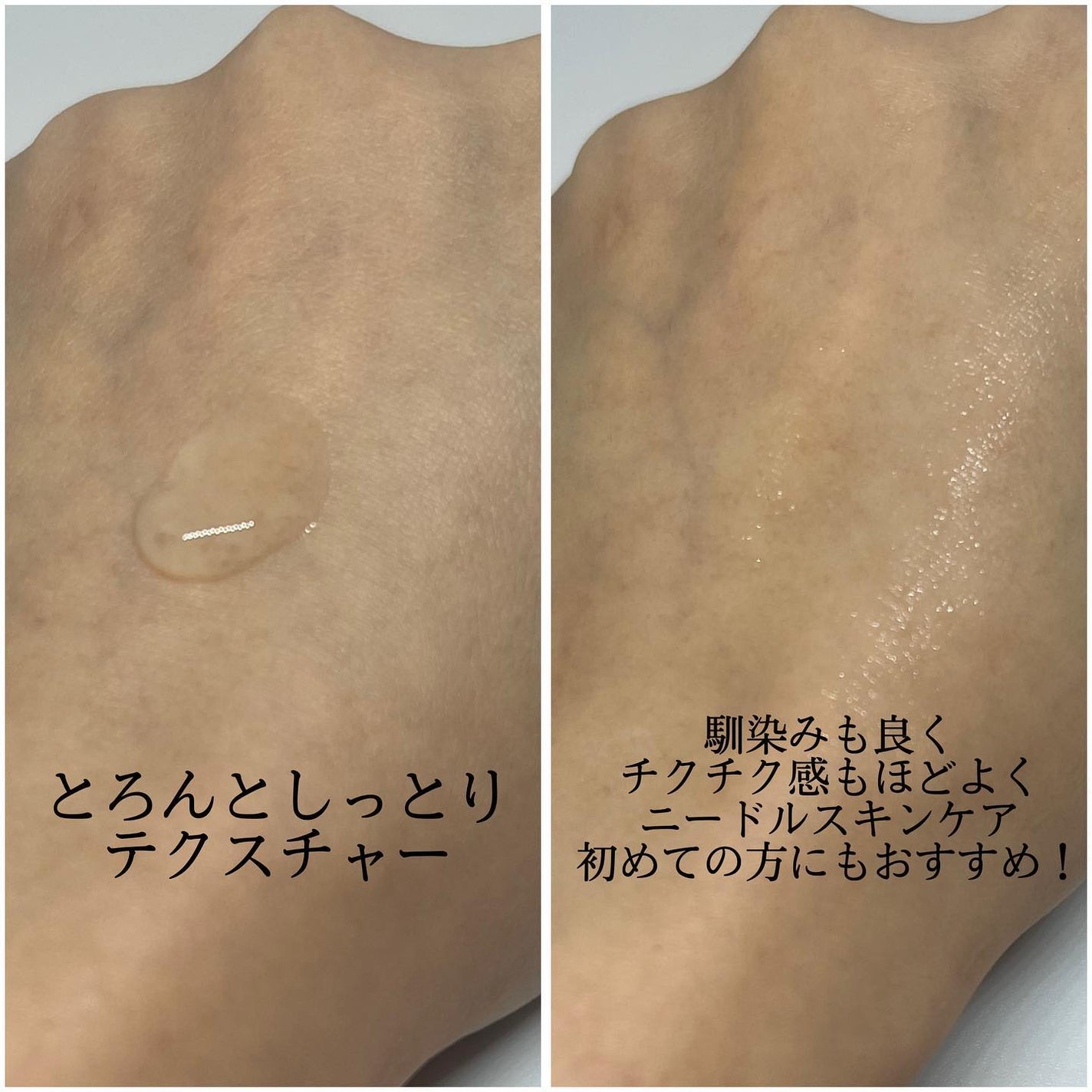 fractionalCC ニードルセラムC/fractionalCC/美容液を使ったクチコミ(3枚目)