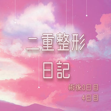 ❁二重整形日記❁

―術後3日目―
痛みはないけど、洗顔のとき目に手を当てた時ちょっと痛かった
腫れが治まってきた
飲酒は腫れがおさまるまでしない方がいい
てか、お酒弱くて飲めない（笑）
目が開きやすく