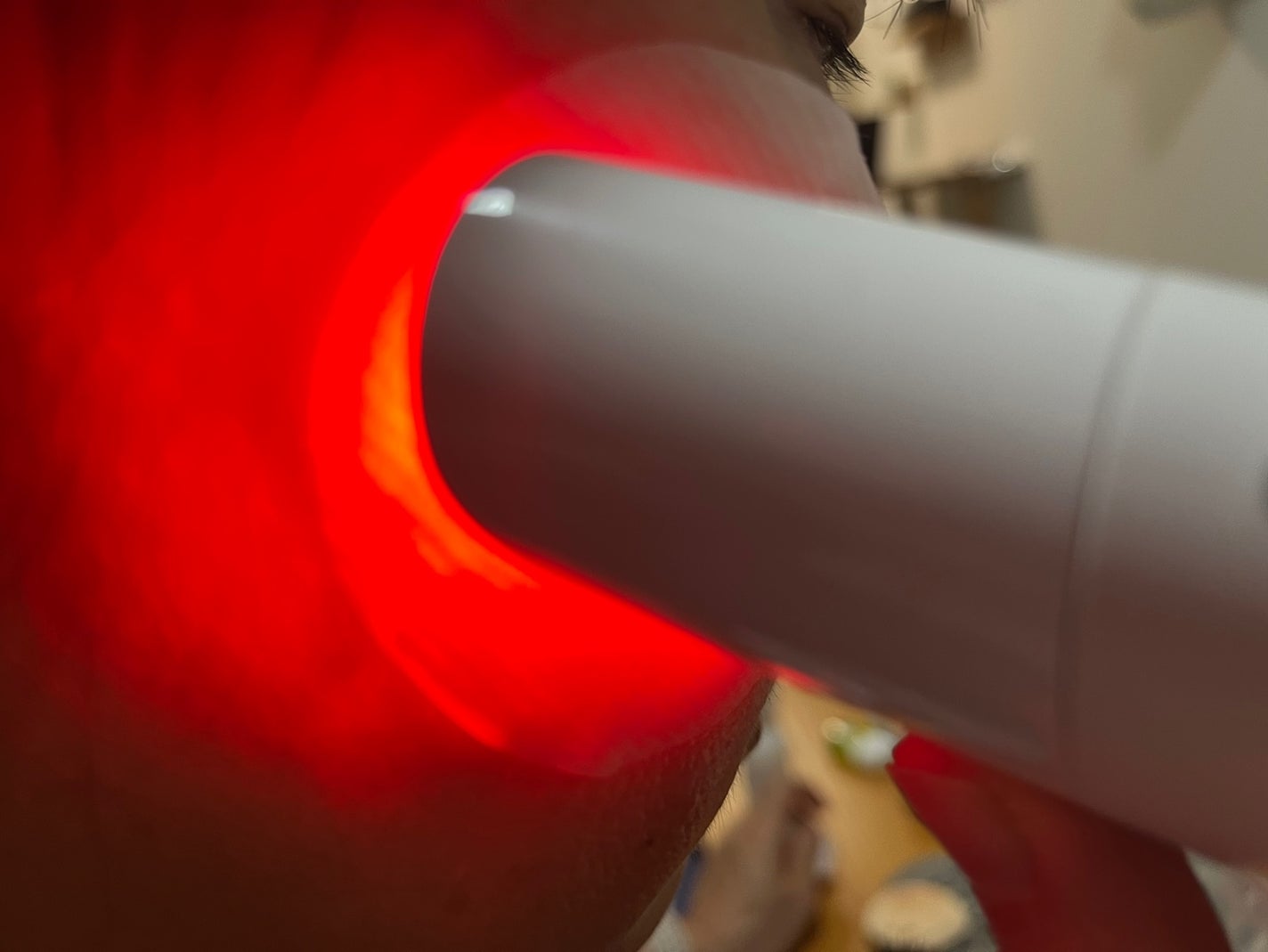 スキンライトセラピーII/Makeon/美顔器・マッサージを使ったクチコミ(1枚目)