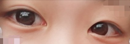 超モテコンウルトラマンスリー/モテコン/１ヶ月（１MONTH）カラコンを使ったクチコミ（1枚目）