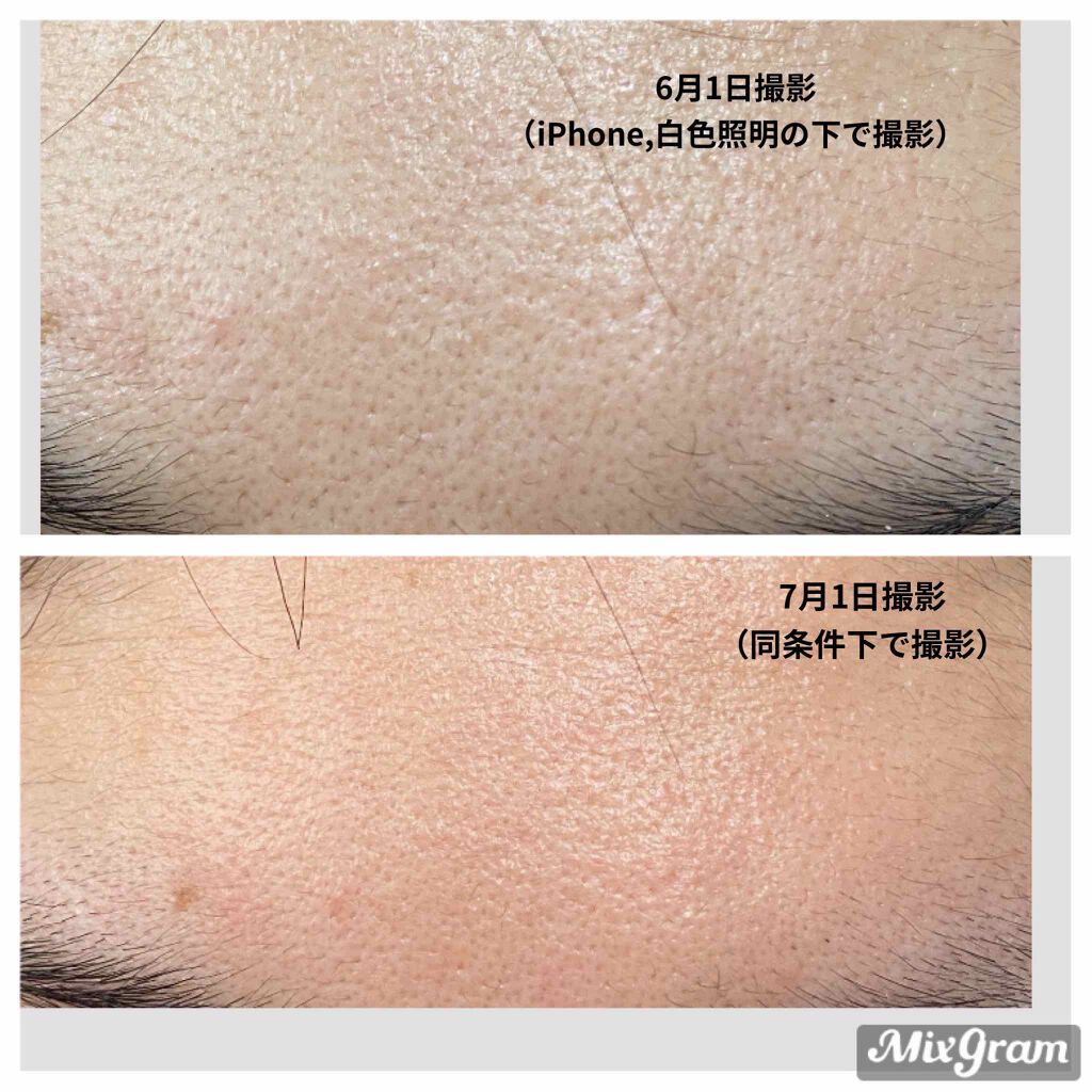 R.N.A. パワー ラディカル ニュー エイジ/SK-II/乳液を使ったクチコミ（2枚目）