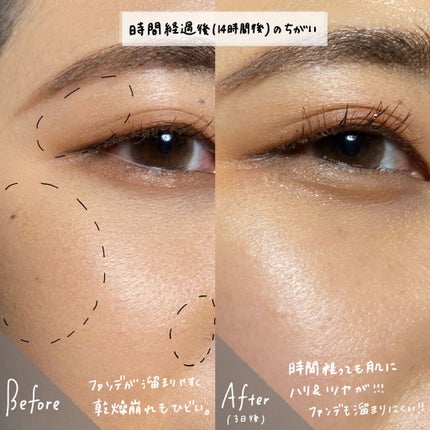 KEYキイ on LIPS 「【"大人の肌をなかったことに"してくれるスキンケアアイテム】W..」(6枚目)