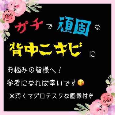 MIKU on LIPS 「💎背中ニキビの治療経過💎まず、汚い背中を晒してすみません🙇‍♀..」（1枚目）