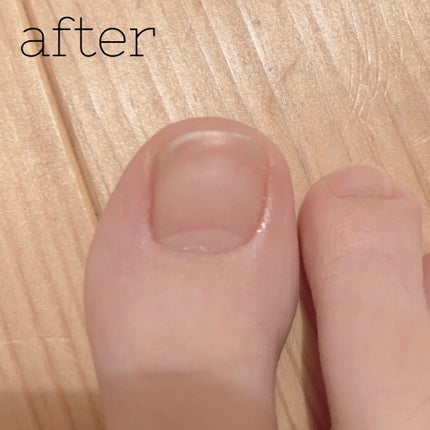 AC サロンネイル トリートメント/WATTS/ネイルオイル・トリートメントを使ったクチコミ(5枚目)