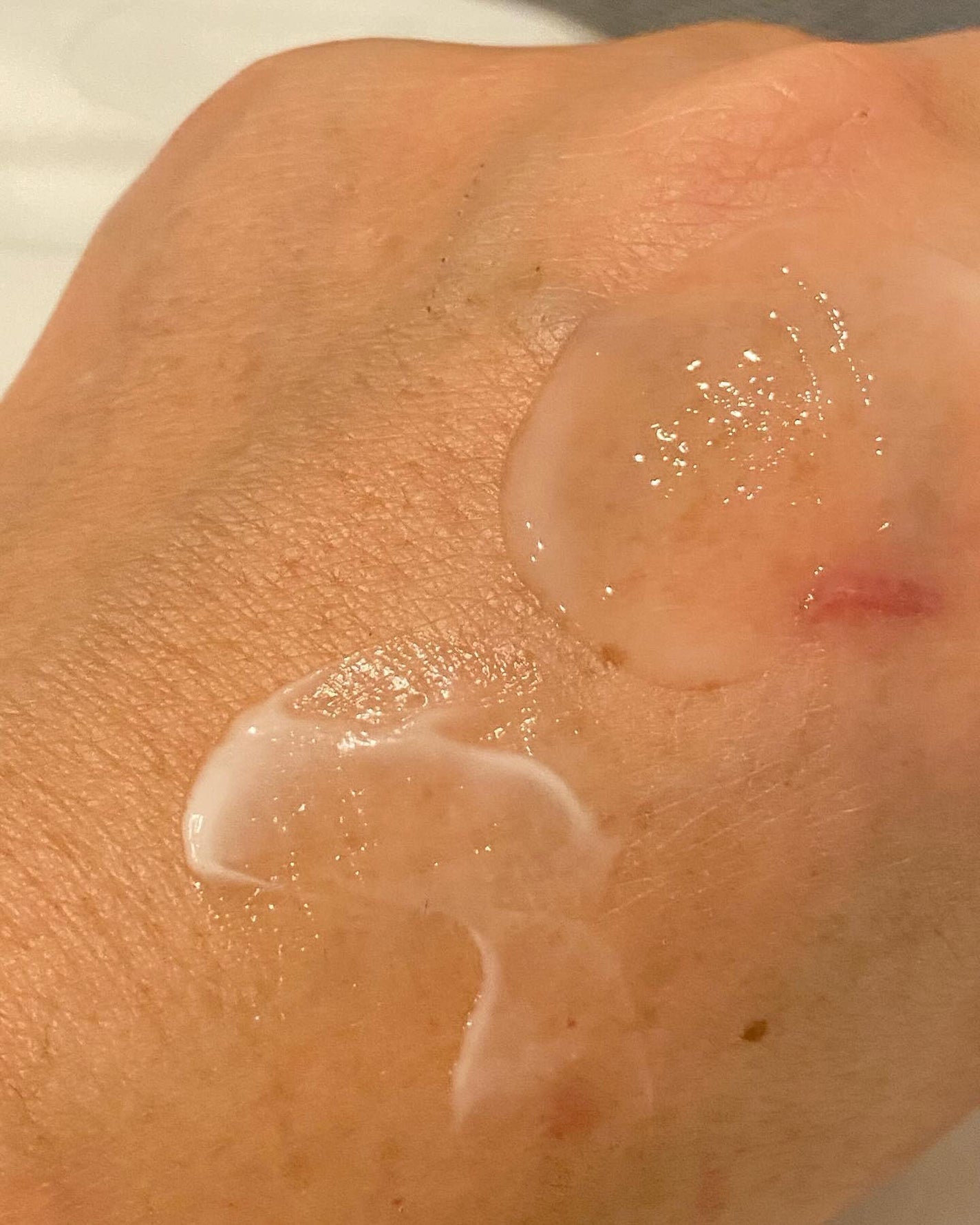 マイルドリードルショット50/VT/美容液を使ったクチコミ(4枚目)