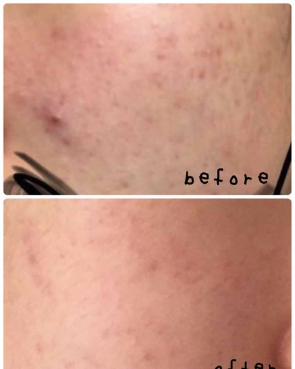 明色美顔水 薬用化粧水/美顔/化粧水を使ったクチコミ(2枚目)