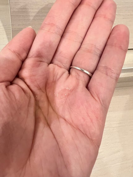 ケアナボーテ VC10 濃美容液/ケアナボーテ/美容液を使ったクチコミ(4枚目)