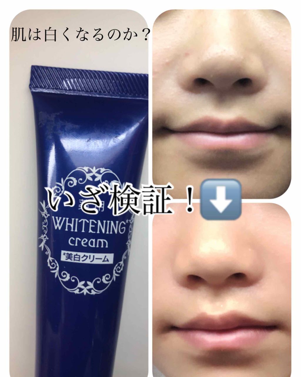 薬用美白 美容液 Daisoの口コミ 話題の薬用美白クリームは本当に白くなるのか By なちゅらる Lips