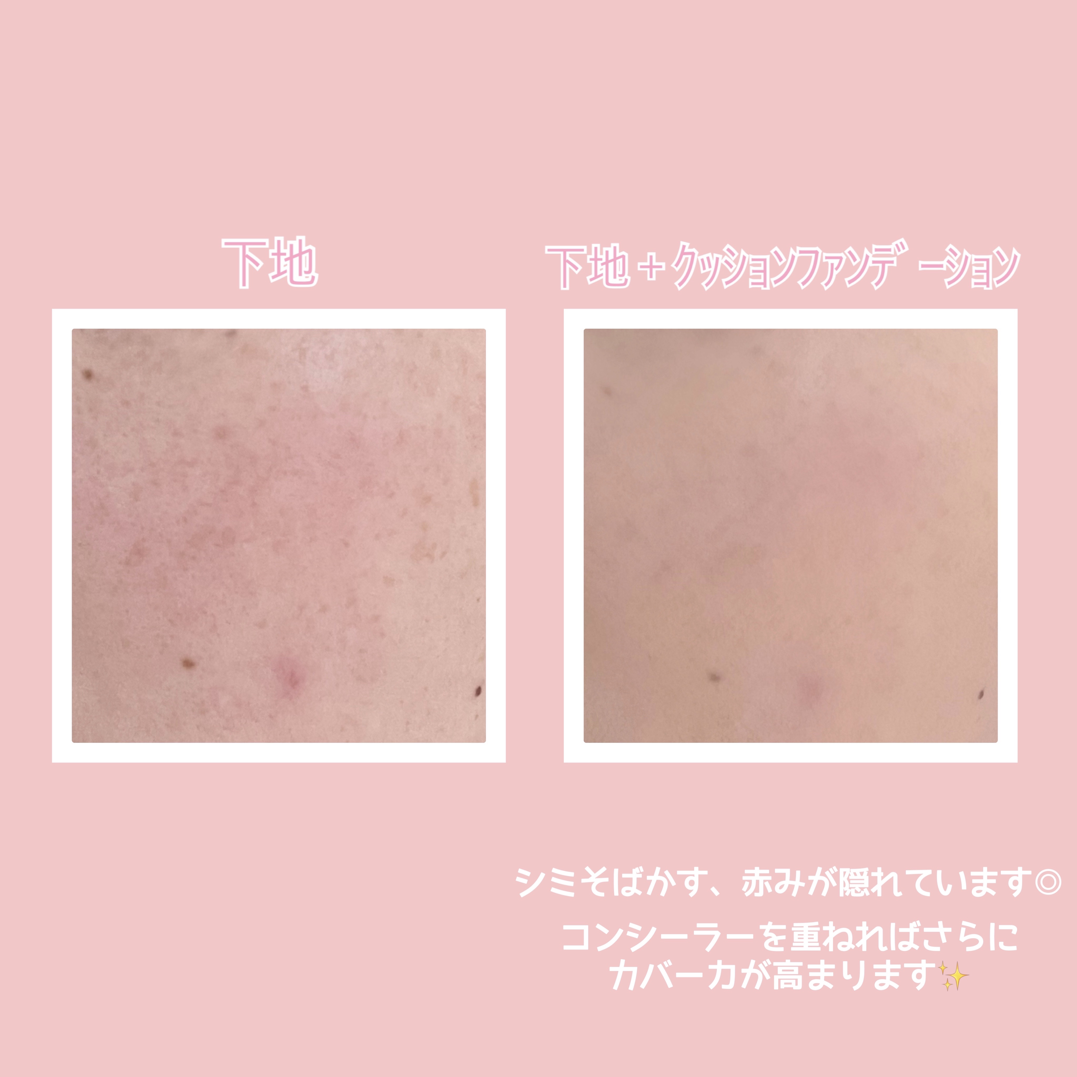 ピンクティーツリーカバークッション/APLIN/クッションファンデーションを使ったクチコミ（3枚目）