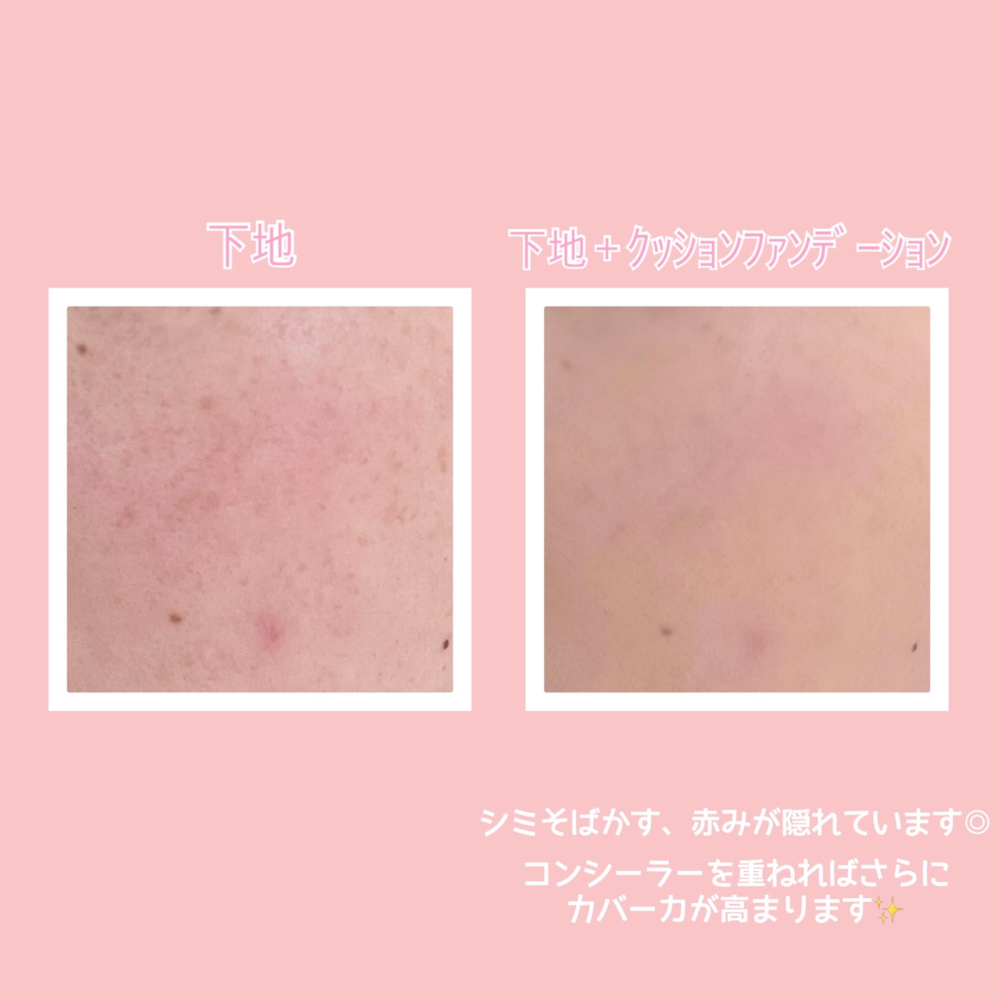 ピンクティーツリーカバークッション/APLIN/クッションファンデーションを使ったクチコミ(3枚目)