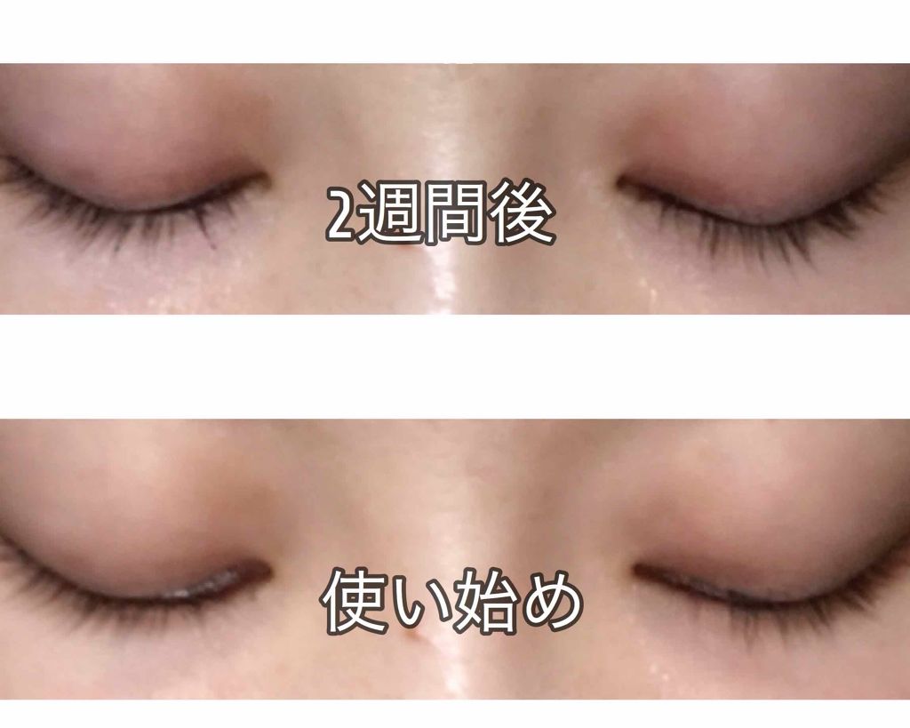 エグータム/アルマダスタイル/まつげ美容液を使ったクチコミ(1枚目)