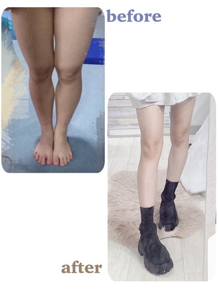 DHC メリロート/DHC/ボディサプリメントを使ったクチコミ(2枚目)