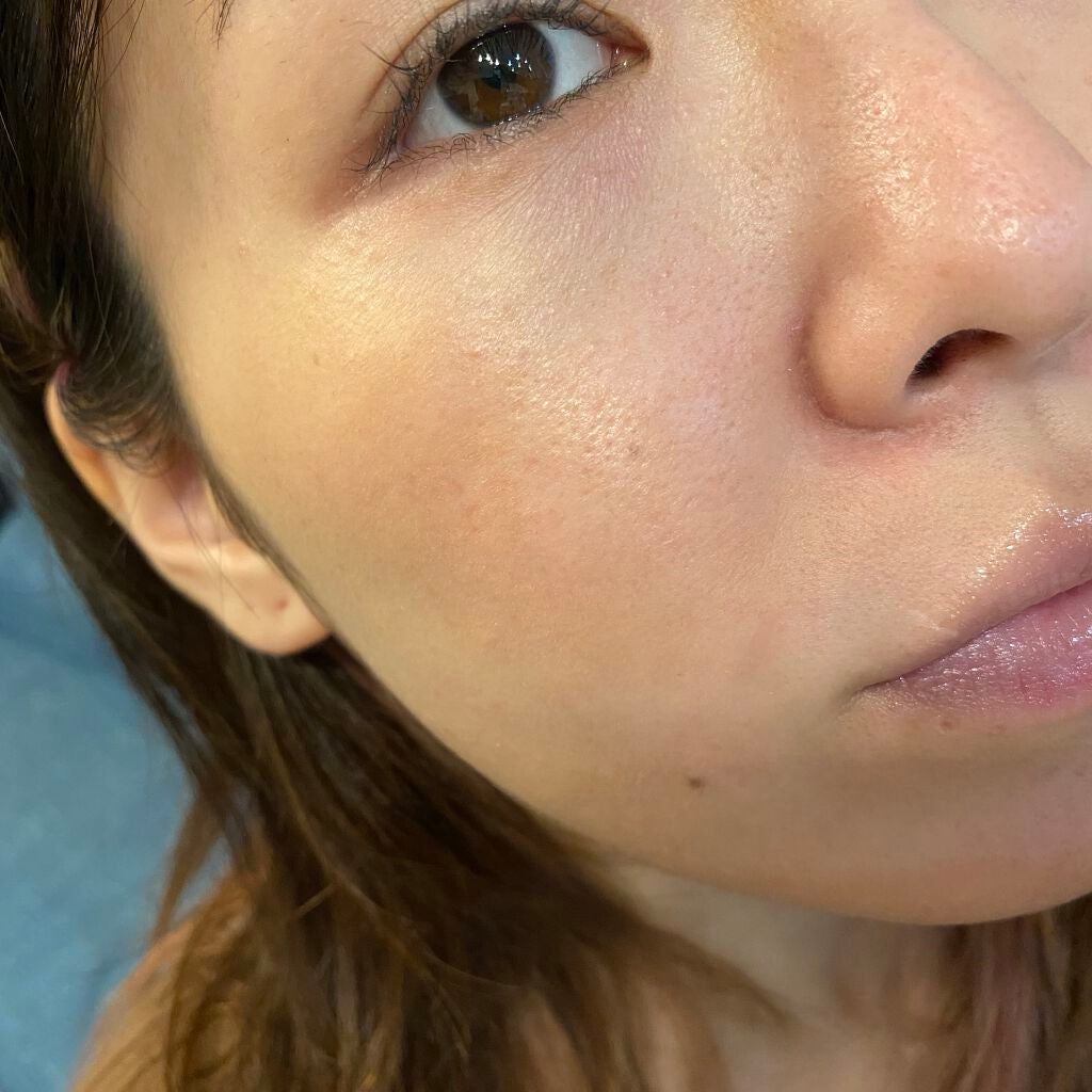 カプチュール ドリームスキン モイスト クッション SPF50 /PA+++ /Dior/クッションファンデーションを使ったクチコミ(4枚目)