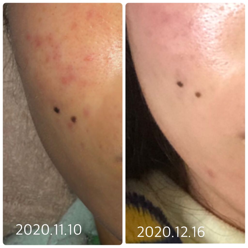 ジェルメイク落とし/キュレル/クレンジングジェルを使ったクチコミ（3枚目）