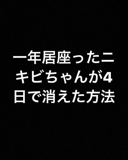 ハトムギ化粧水(ナチュリエ スキンコンディショナー R )/ナチュリエ/化粧水を使ったクチコミ(1枚目)