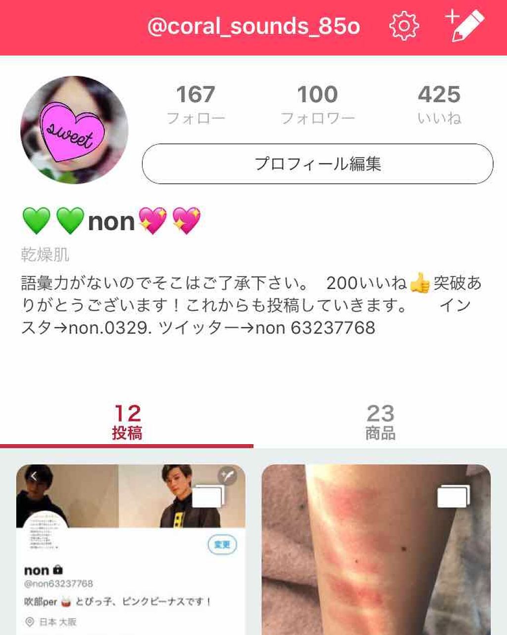 ððnonðð on LIPS ãæè¿ã¬ãã¥ãŒãšãããŠãªããŠæ¬åœã«ãã¿ãŸããããŸããŸãéè«ãªã®ã§..ãïŒ1æç®ïŒ