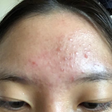 ディープモイスチャースプレー/キュレル/ミスト状化粧水を使ったクチコミ(3枚目)