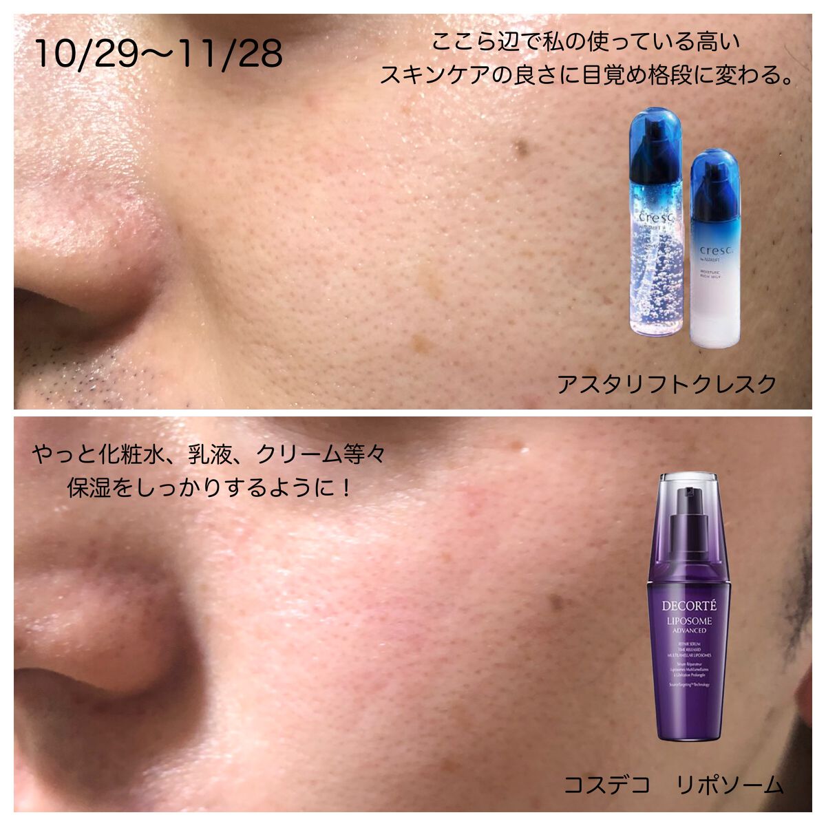 リポソーム アドバンスト リペアセラム/DECORTÉ/美容液を使ったクチコミ(4枚目)