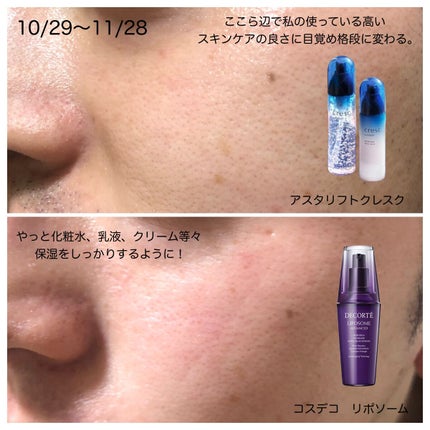 リポソーム アドバンスト リペアセラム/DECORTÉ/美容液を使ったクチコミ(4枚目)