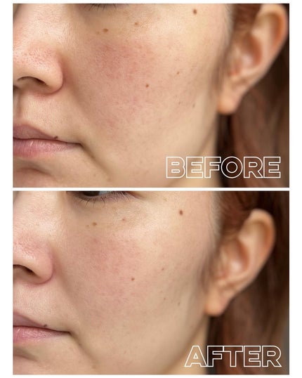 モイストラボ ルースパウダー/Moist Labo/ルースパウダーを使ったクチコミ(6枚目)