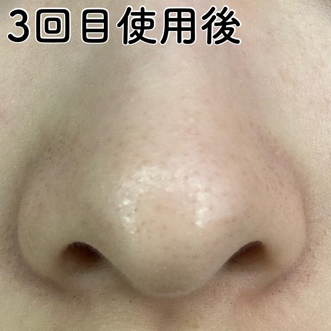 ノーモアブラックヘッド(ノーズピーリング)/One-day's you/スクラブ・ゴマージュを使ったクチコミ(4枚目)