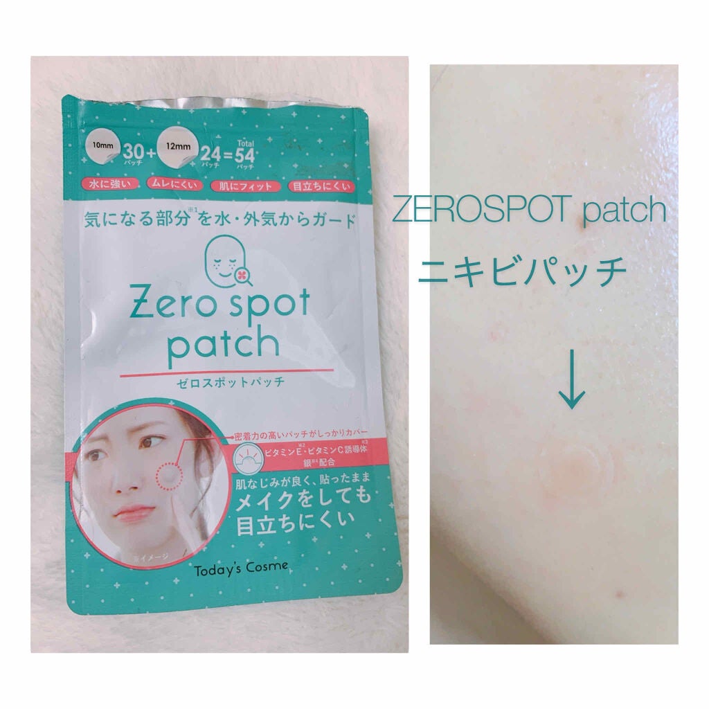 ゼロスポットパッチ/Today’s Cosme/にきびパッチを使ったクチコミ(1枚目)