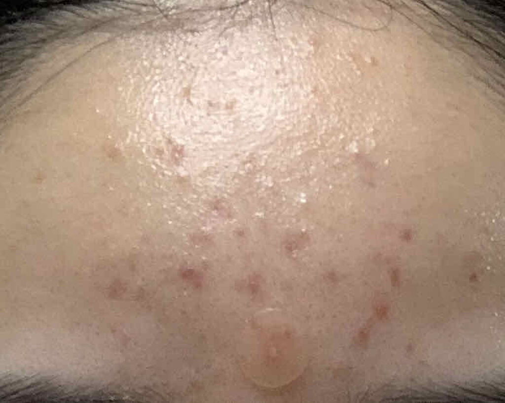 はちみつ洗顔石鹸/HACCI/洗顔石鹸を使ったクチコミ（2枚目）