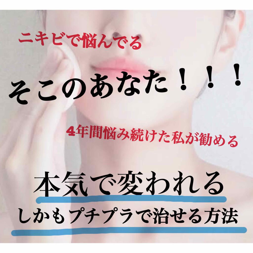 薬用クリーム洗顔/メンソレータム アクネス/洗顔フォームを使ったクチコミ(1枚目)