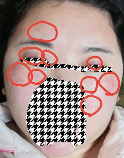 薬用ローション(とてもしっとり)/IHADA/化粧水を使ったクチコミ(4枚目)