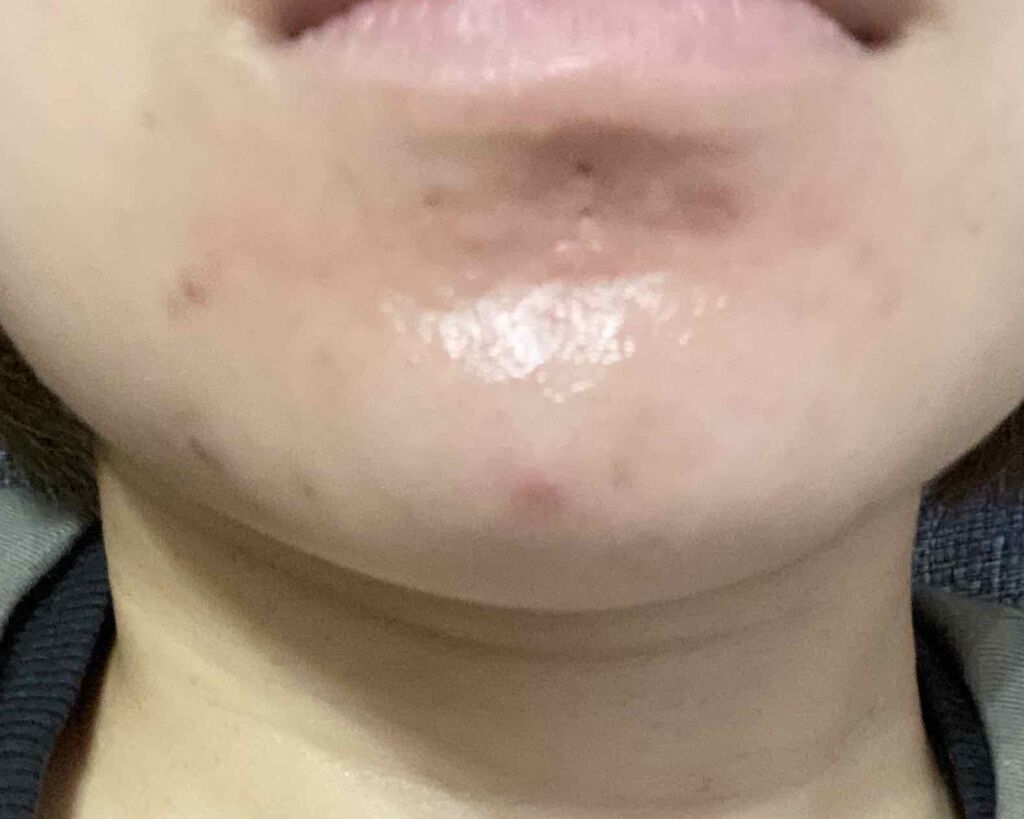 ザ・タイムR アクア/IPSA/化粧水を使ったクチコミ(4枚目)