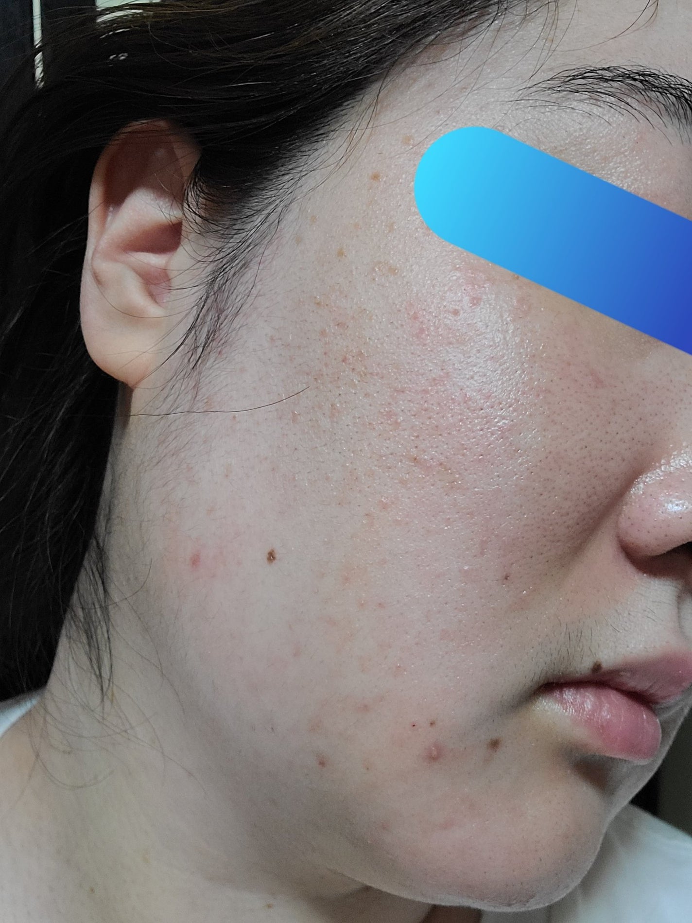 ハイドロクリーム SHQ-10/KISO/フェイスクリームを使ったクチコミ(4枚目)