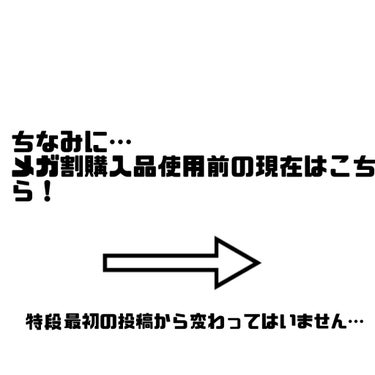 エイジインテンストリートメント スペシャルセット/FROM NATURE/スキンケアキットを使ったクチコミ（4枚目）