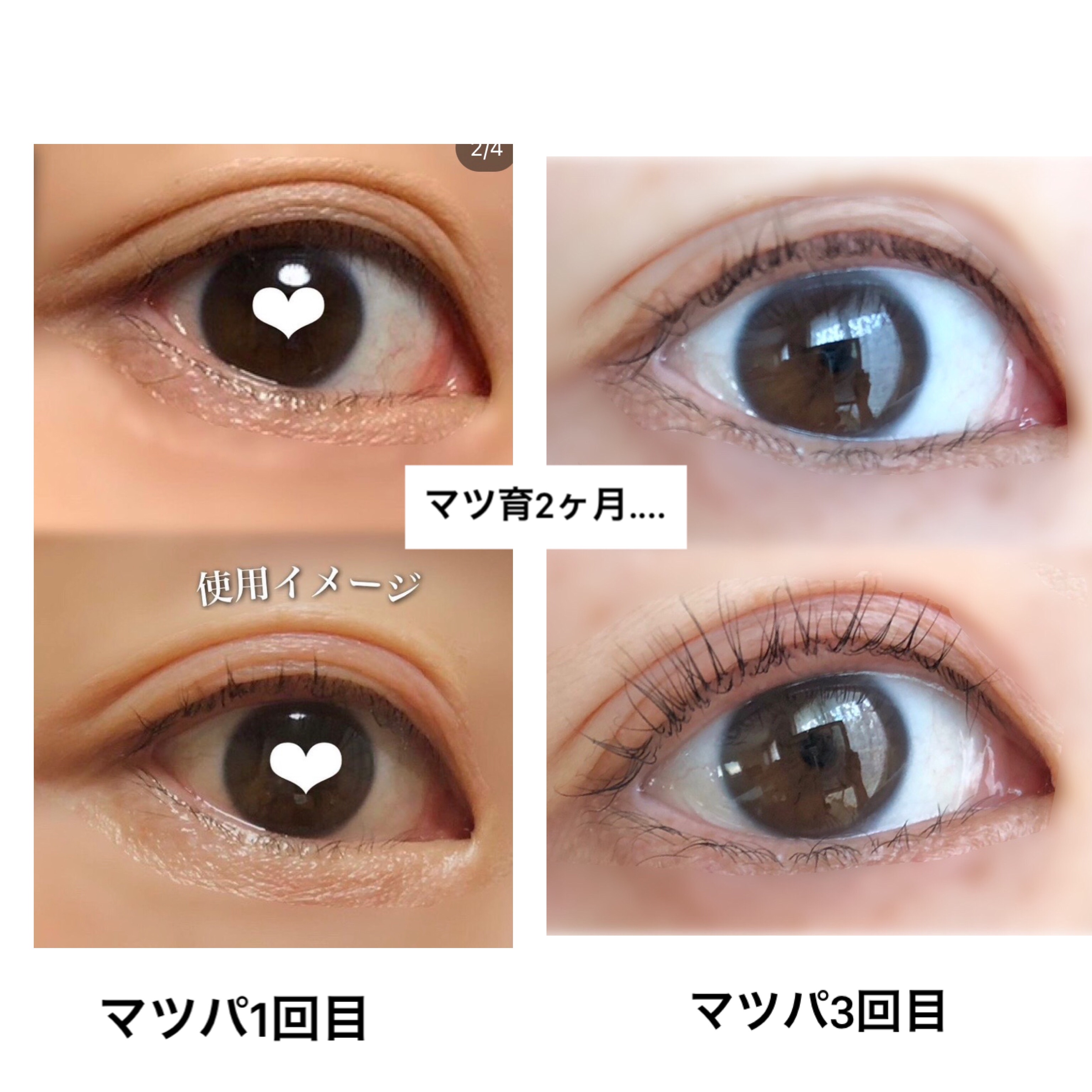 エクストラ ロングラッシュ/YOUUP(海外)/まつげ美容液を使ったクチコミ（3枚目）