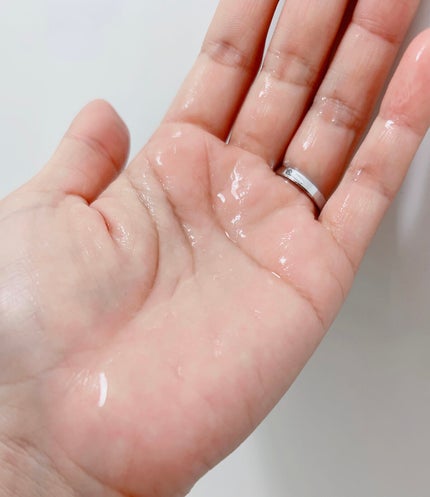 薬用マイクロバブルローション/Macchia Label/化粧水を使ったクチコミ(6枚目)