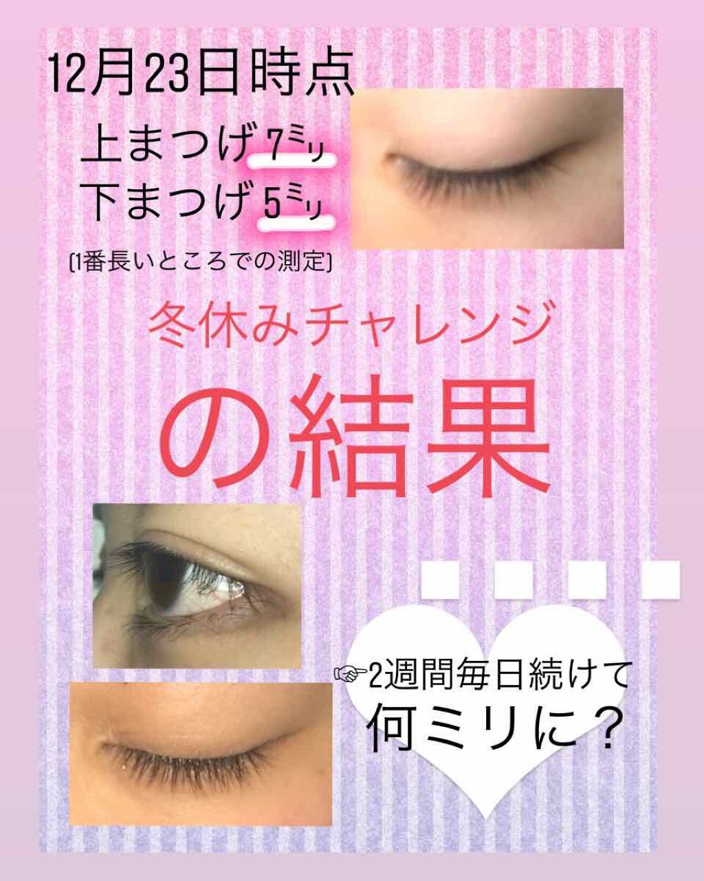 ローヤルゼリー配合 栄養ローション/DAISO/美容液を使ったクチコミ(1枚目)