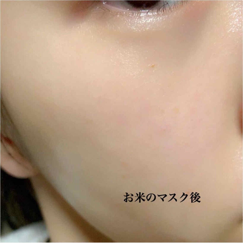 お米のマスク/毛穴撫子/シートマスク・パックを使ったクチコミ(2枚目)