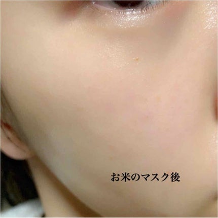 お米のマスク/毛穴撫子/シートマスク・パックを使ったクチコミ(2枚目)