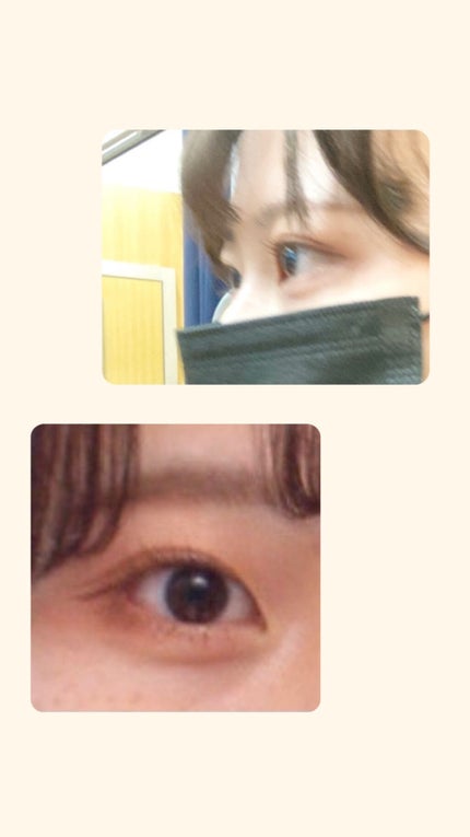 のび〜る アイテープ 両面テープタイプ/DAISO/二重まぶた用アイテムを使ったクチコミ(3枚目)