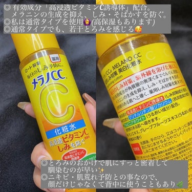 メラノCC 薬用しみ対策 美白化粧水のクチコミ「脂性肌・ニキビ肌の私が使ってるメラノCCシリーズ🌿

・・・・・・・・・・・・・・・・・・・・.....」（2枚目）